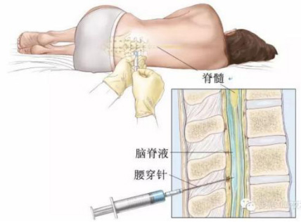 您所在的位置  医生进行消毒和局部麻醉后