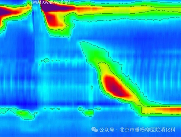 【垂医科普】消化内科：不明原因胸痛、吞咽困难、呕吐，胃镜却未见异常怎么办